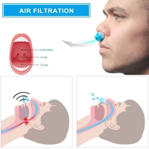 Апарат против хъркане с Филтър за пречистване на въздуха, 1 бр